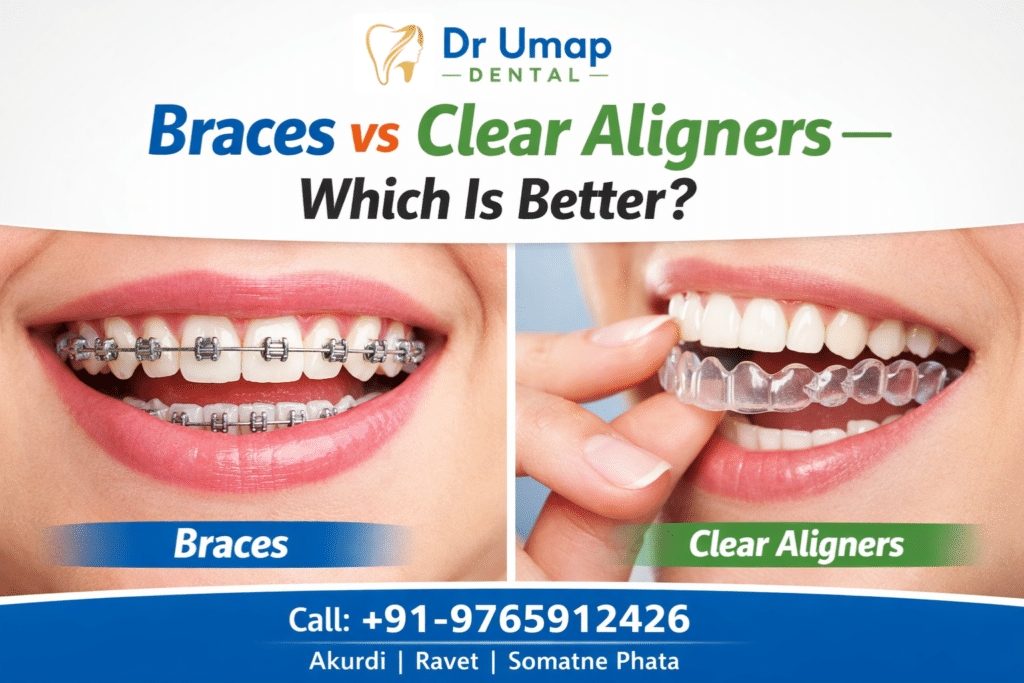 Braces vs Clear Aligners