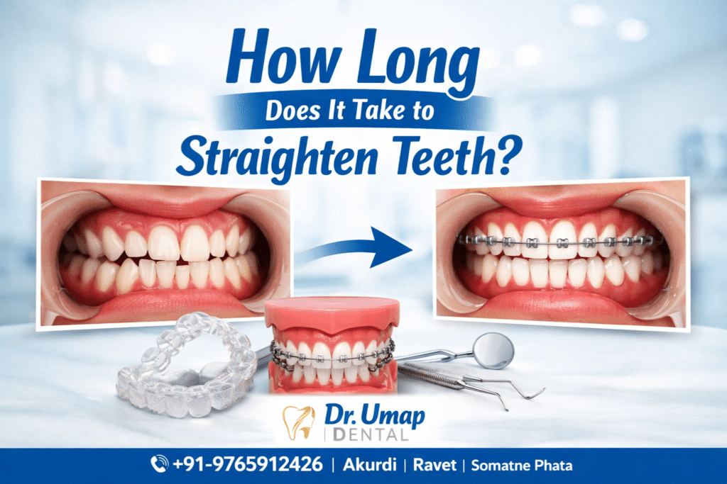 How Long Does It Take to Straighten Teeth?