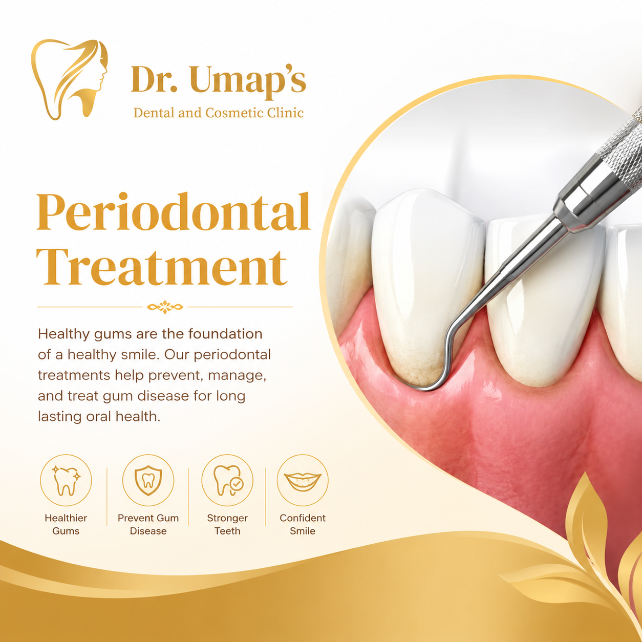 Periodontal Treatment in Pimpri Chinchwad