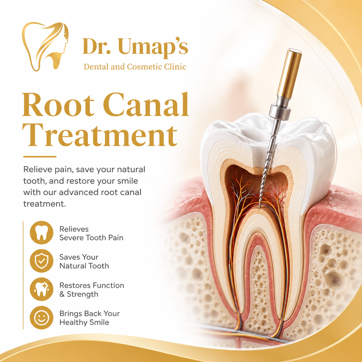 best root canal treatment in Akurdi